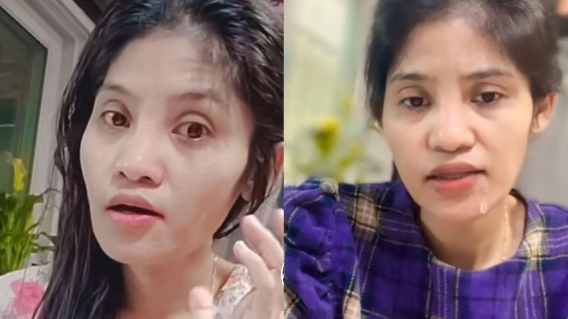 သိန်းတင်မ ခေါ် ဇွန်နီလာဌေးရဲ့ ရောင်နီလာတဲ့ ဆယ်လီမမ xd ပေါက်ကြား